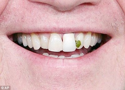 broccoli_in_teeth